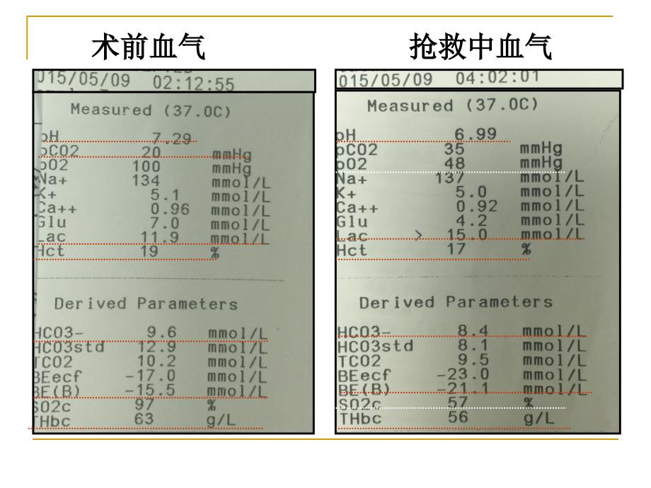 腹腔间隙综合征与麻醉_第4页