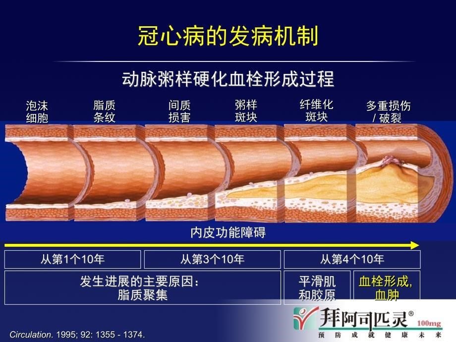 新近冠心病临床专家共识_第5页