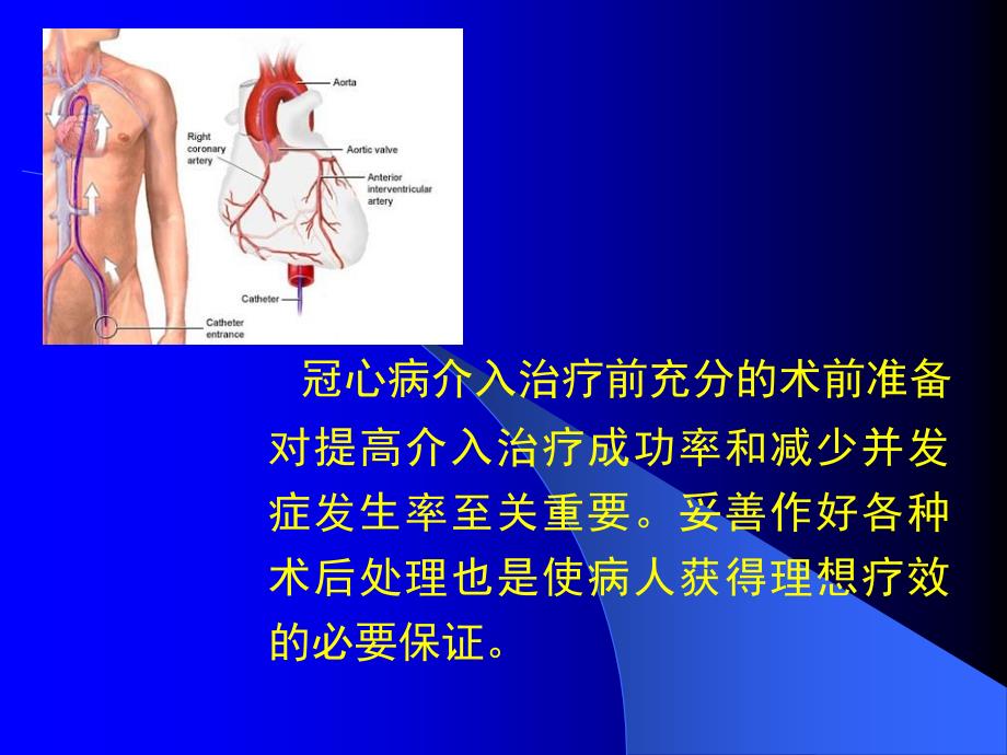 冠心病介入治疗的术前准备和术后处理_第3页