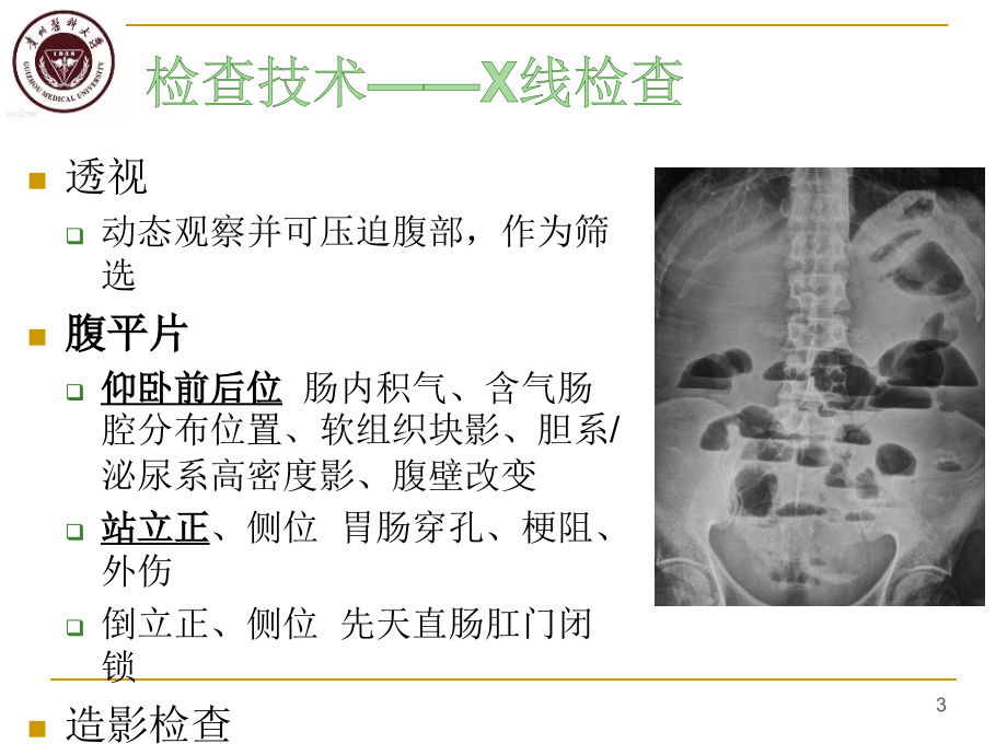 医学影像消化系统-急腹症_第3页