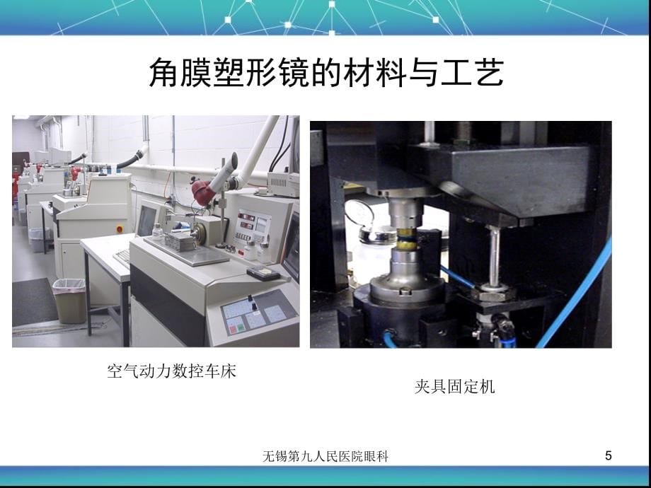 角膜塑形并发症的预防与处理_第5页