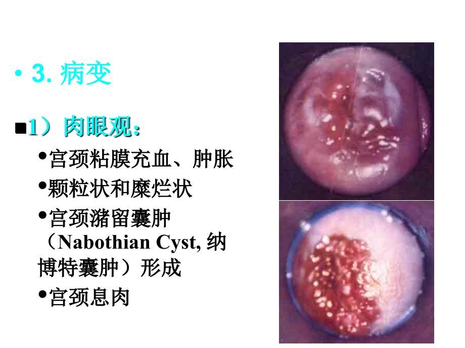 医学常见疾病_第4页