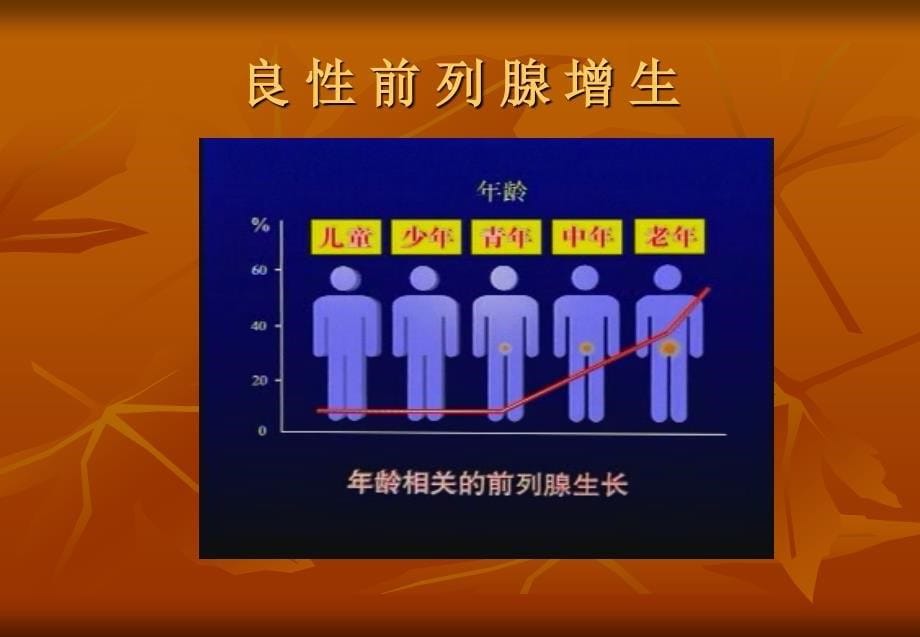 良性前列腺增生及超声消融简说_第5页