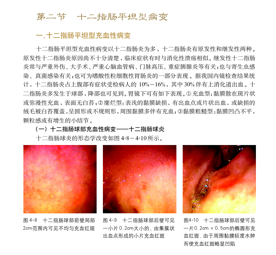 十二指肠疾病的形态学诊断与病理_第3页