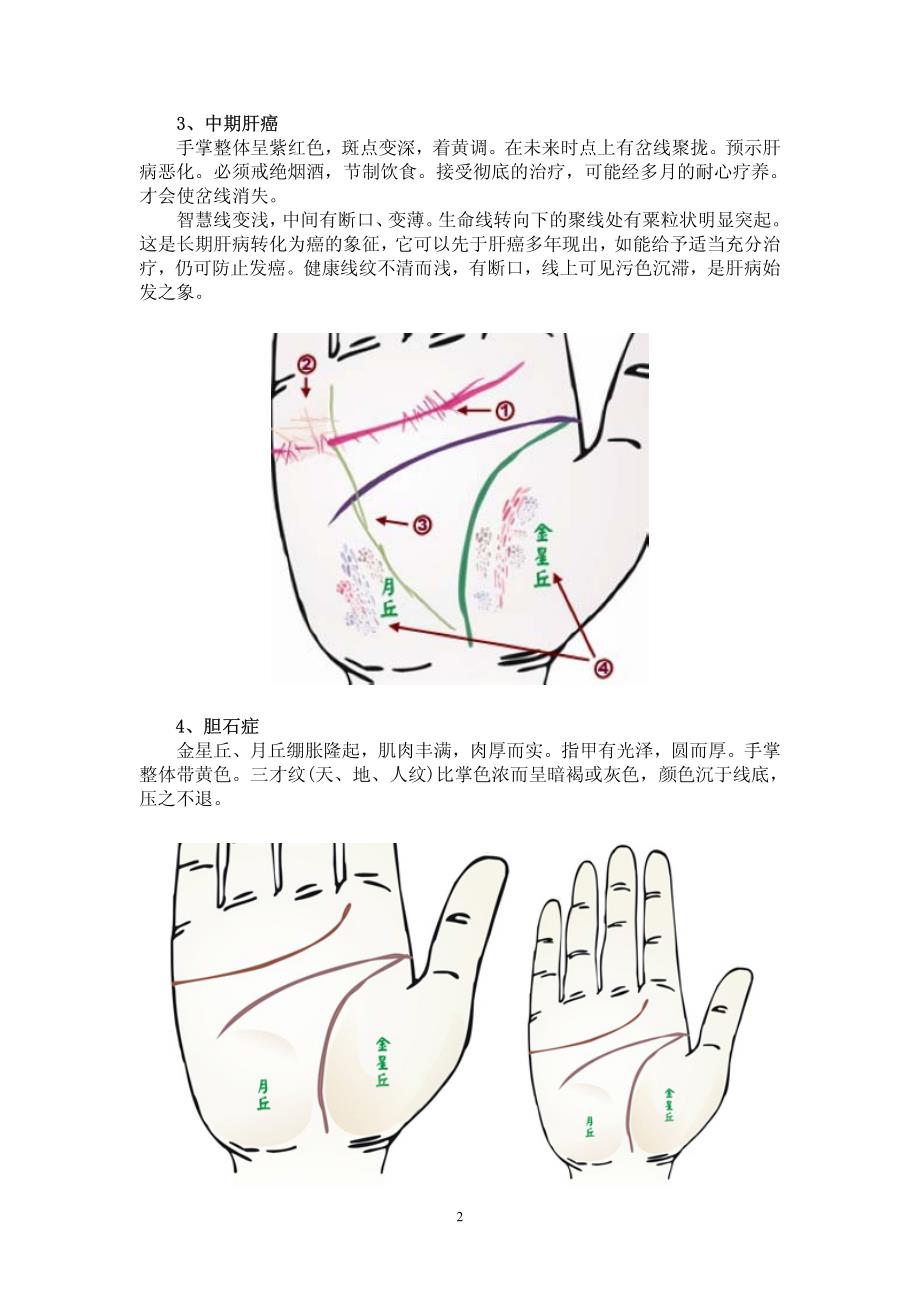 看手相了解你的身心健康_第2页