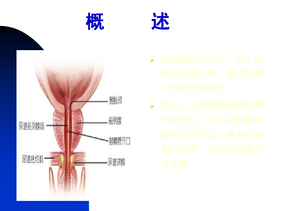 前列腺炎-课件(演示)_第3页