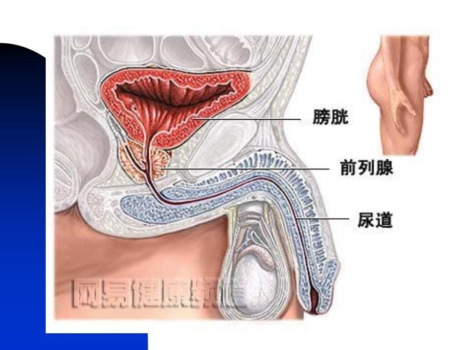 前列腺炎-课件(演示)_第5页