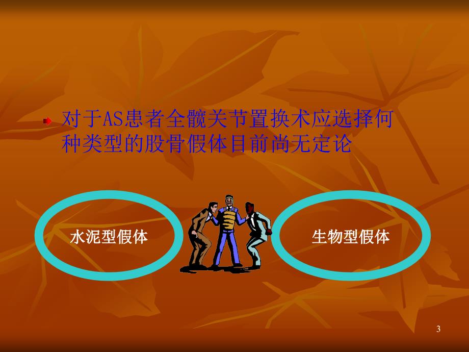 王坤正强直性脊柱炎全髋关节置换术股骨假体的选择_第3页