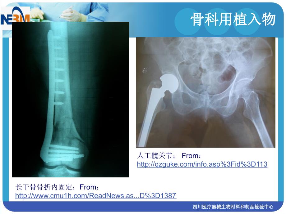 骨科用植入物评价技术简介_第3页