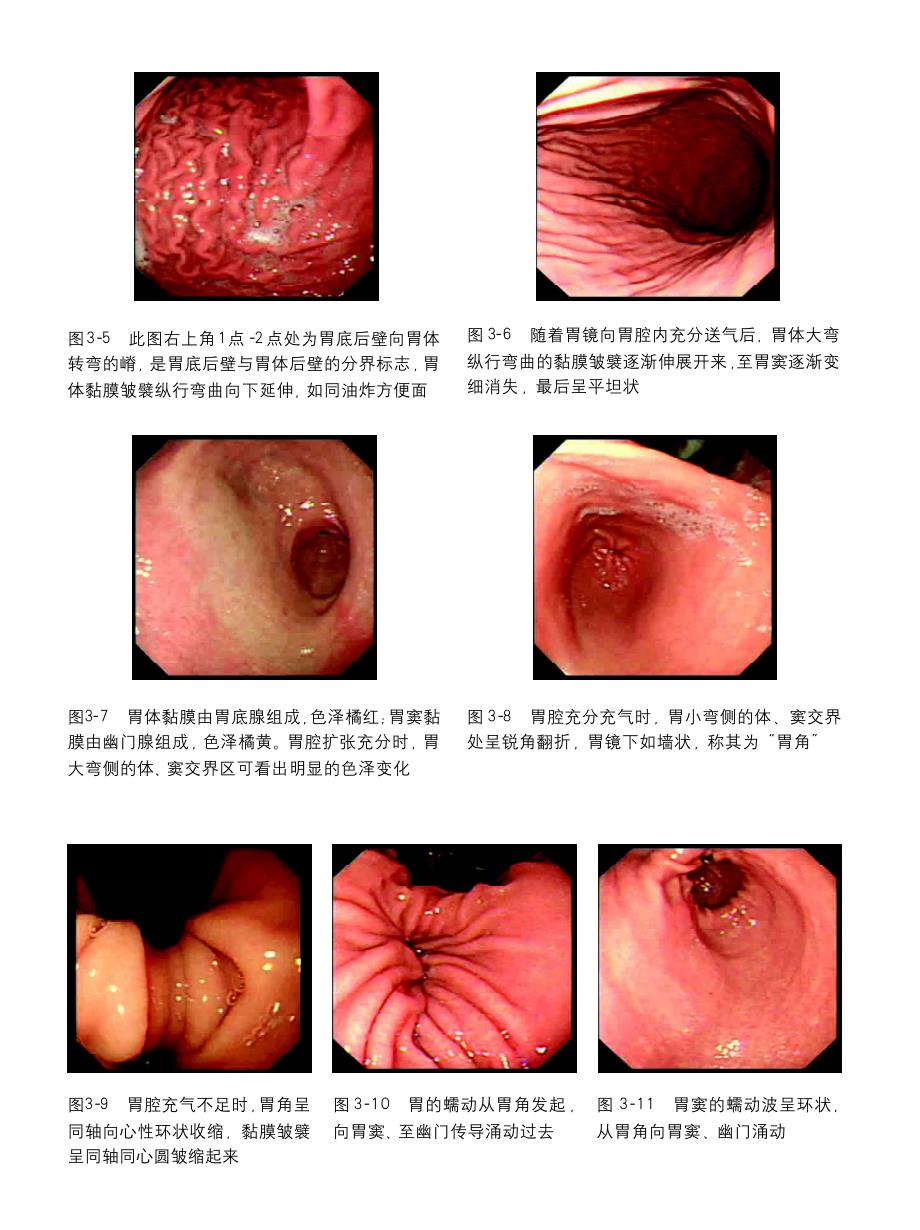 胃疾病的形态学诊断与病理_第2页