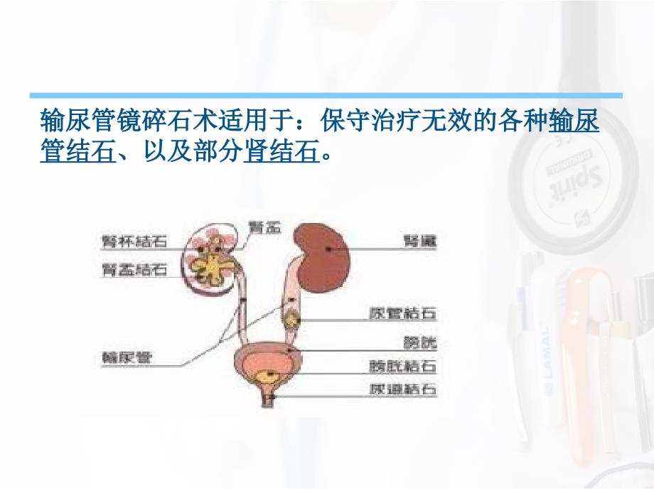 URSL术的护理配合_第3页