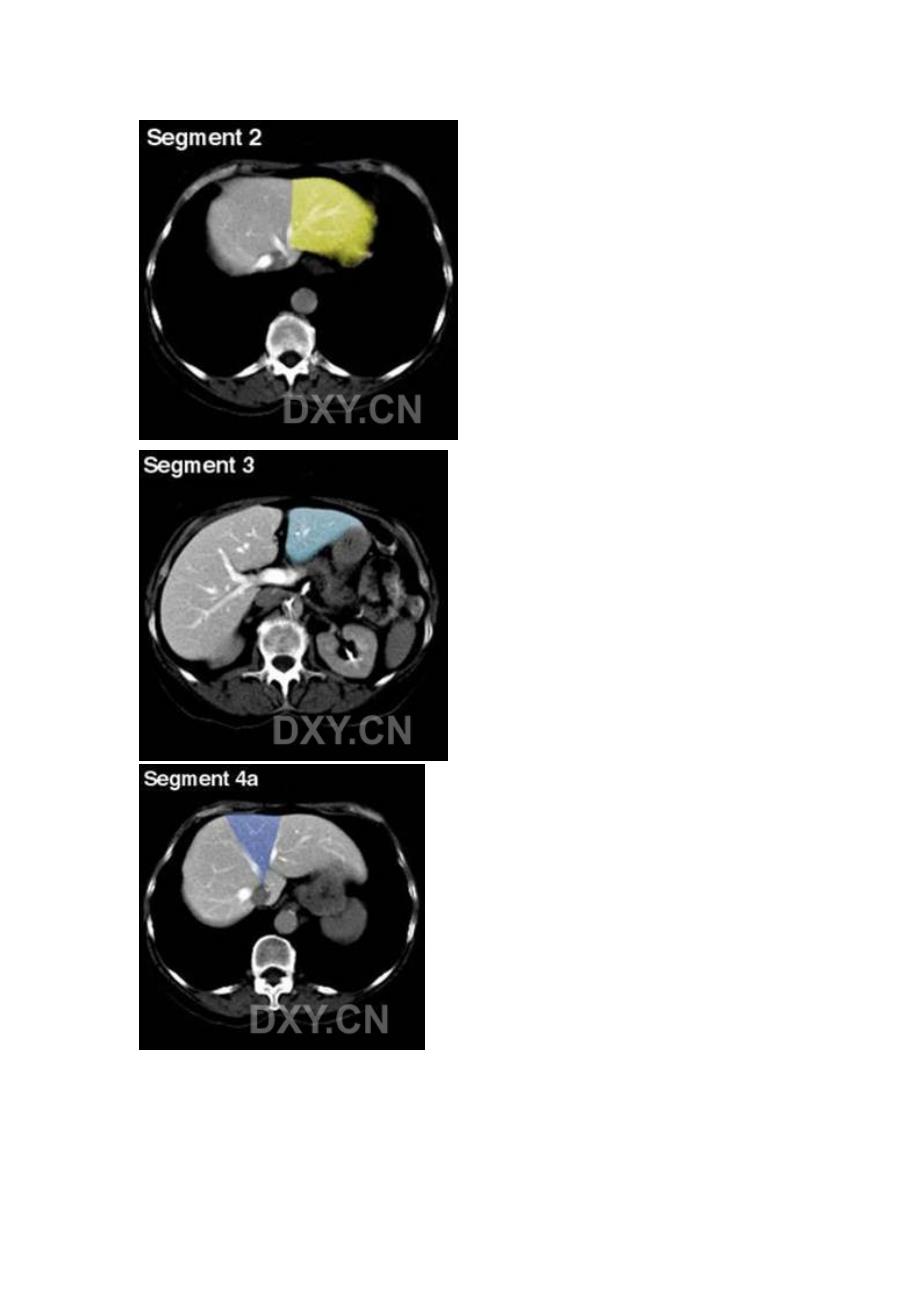 肝脏的ct分段_第2页