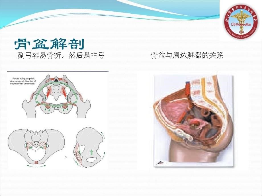 骨盆骨折的分型及治疗_第5页