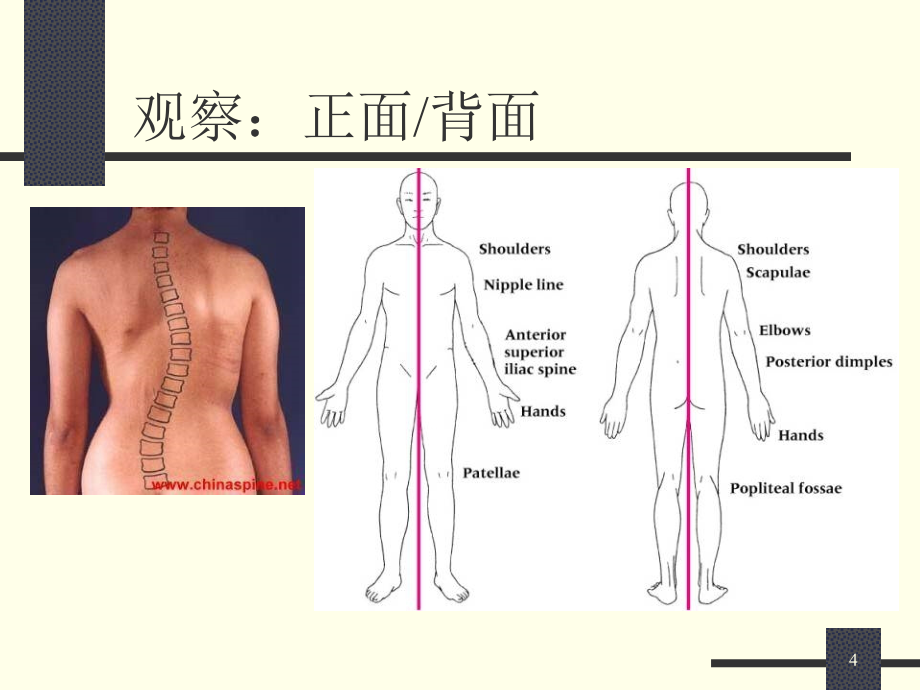 骨科康复功能评定_第4页