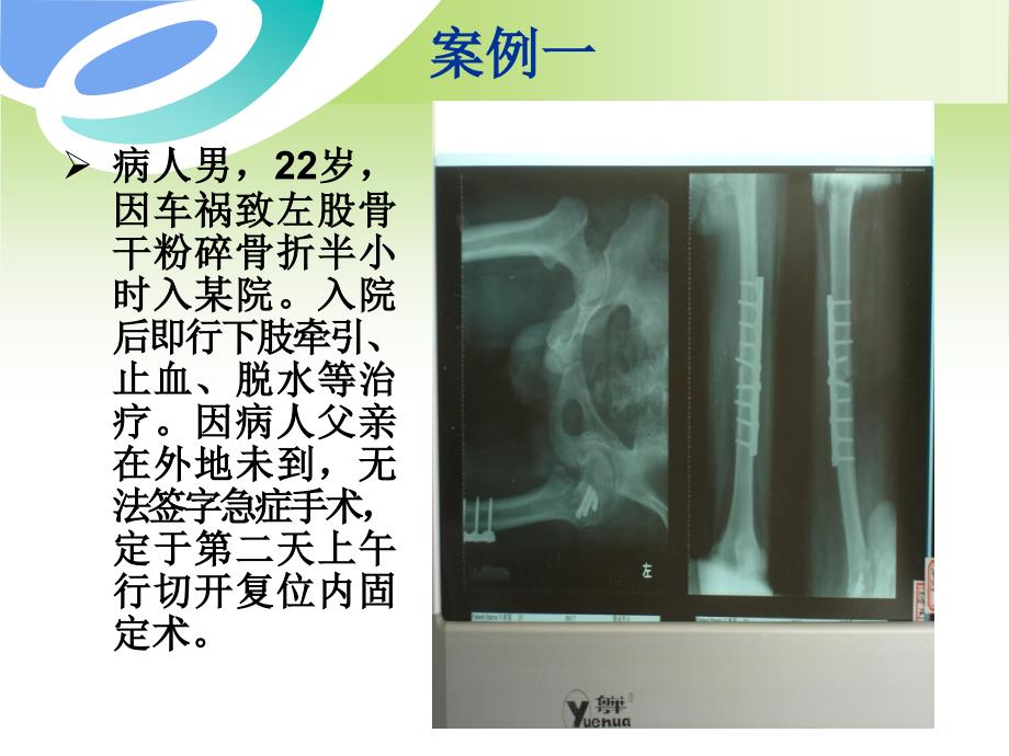 骨科手术纠纷案例分析陈允震_第4页