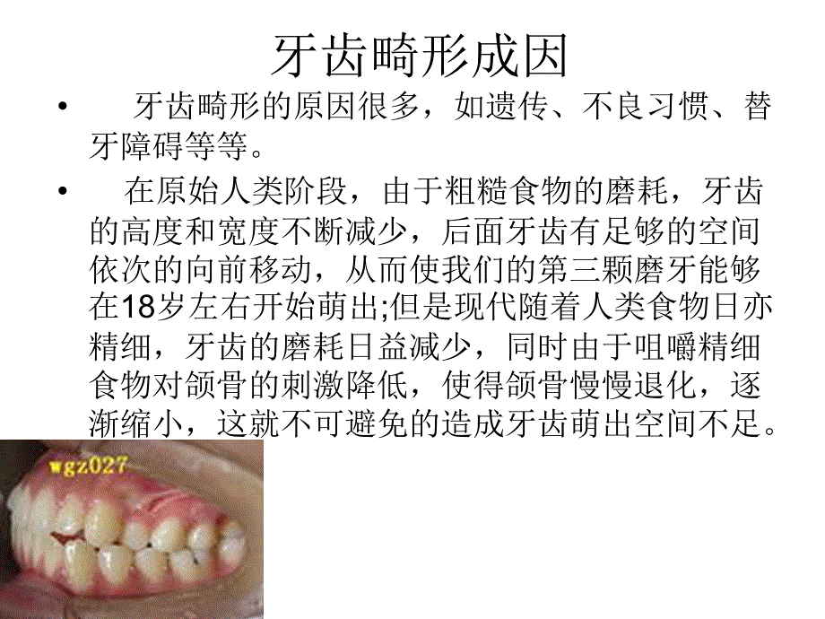 深圳矫正牙齿 口腔医院_第3页
