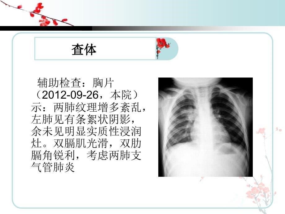 支气管肺炎(儿科)的护理查房_第5页