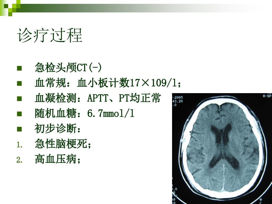 卒中的规范化诊疗与抗栓(泰嘉)_第3页