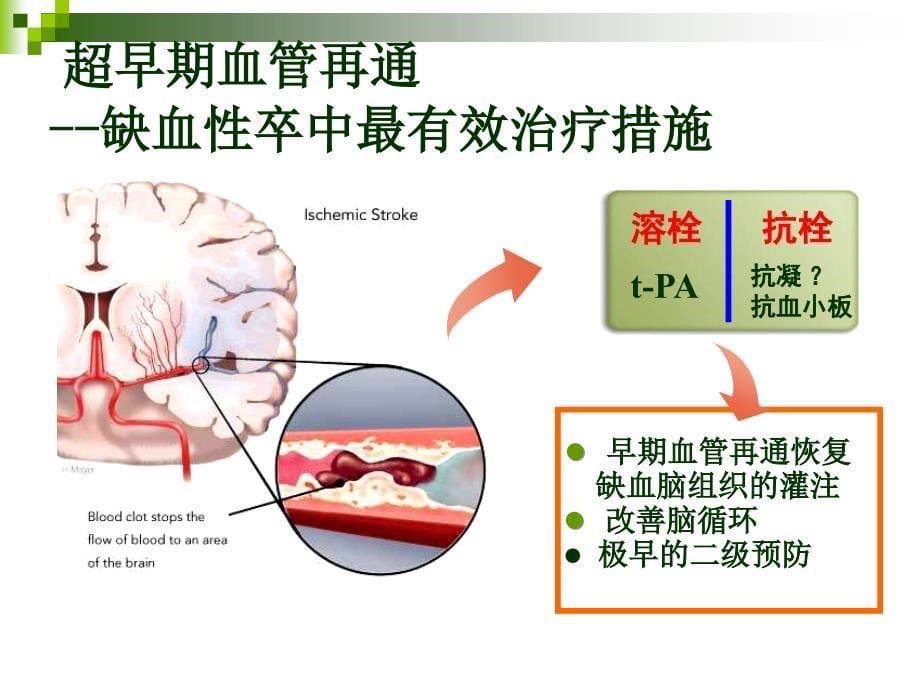 卒中的规范化诊疗与抗栓(泰嘉)_第5页