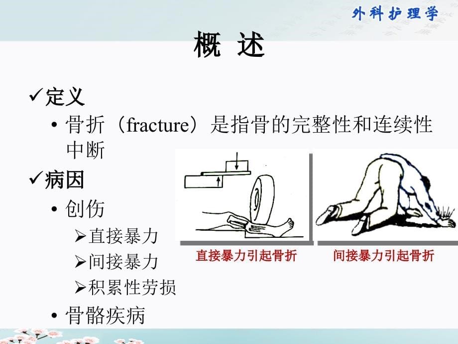 外科护理学-骨折病人的护理_第5页