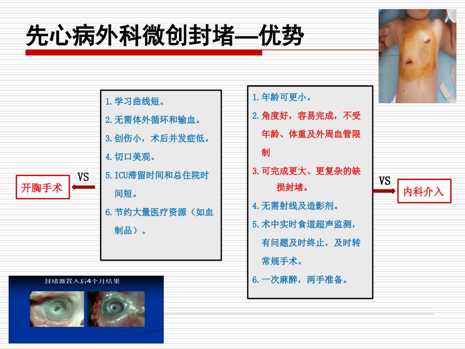 外科微创封堵治疗先心病的陷阱和应对策略—修改版本_第4页