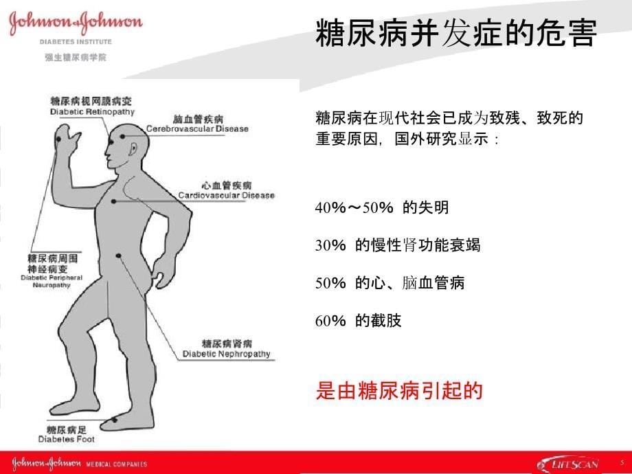 糖尿病并发症体验教具教学_第5页