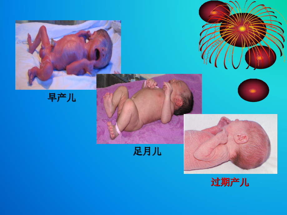 新生儿与新生儿疾病患儿的护理_第3页