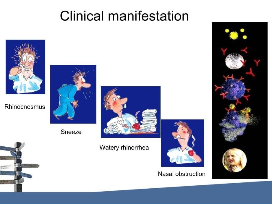 变应性鼻炎(ppt课件)_第5页