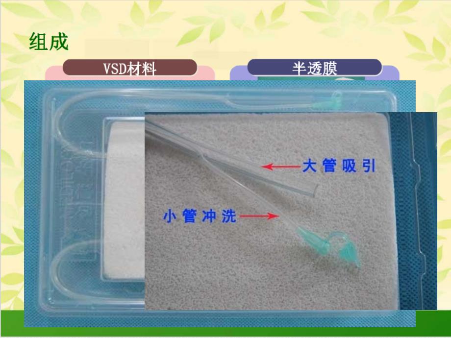 VSD技术的临床应用_第4页