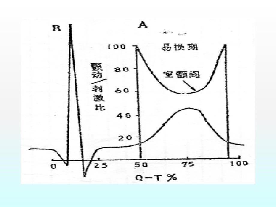 直流电复律和除颤_第5页