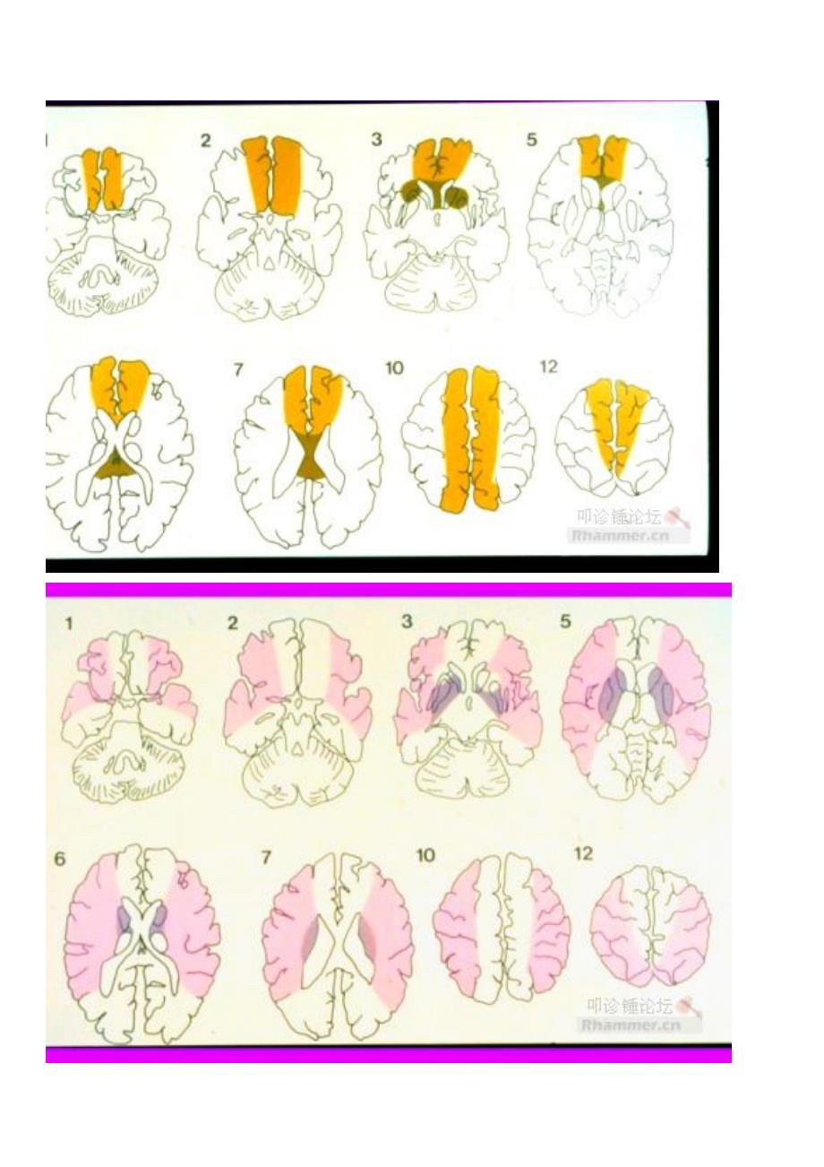 脑动脉的供血区域_第4页