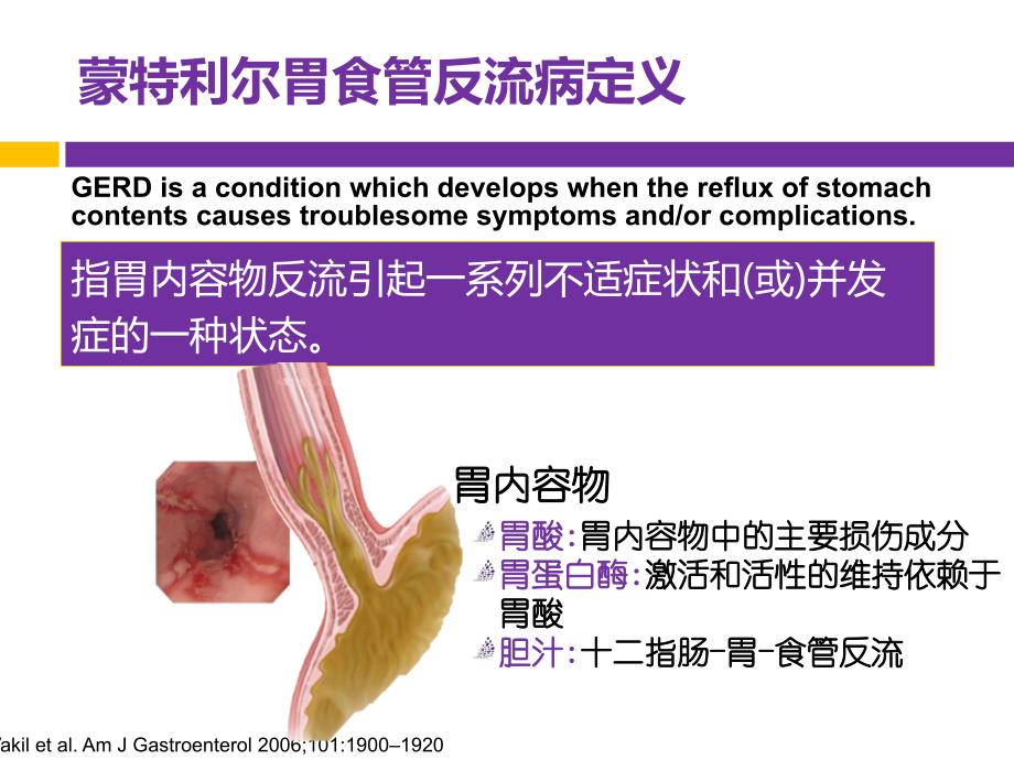 美国GERD指南解读--诊断篇 (1)_第2页