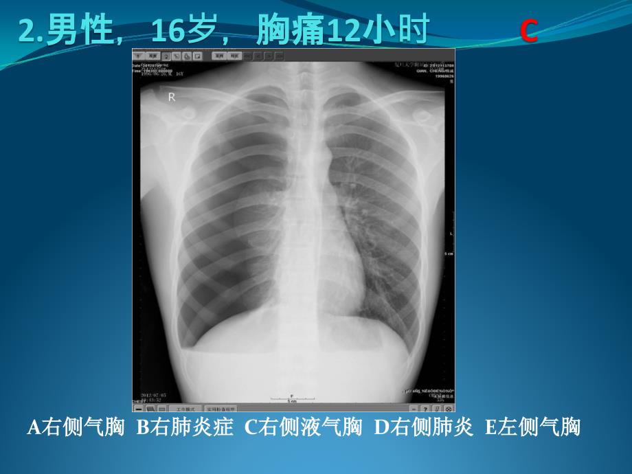 上海住院医生规范化培训结业考必看-影像部分_第2页