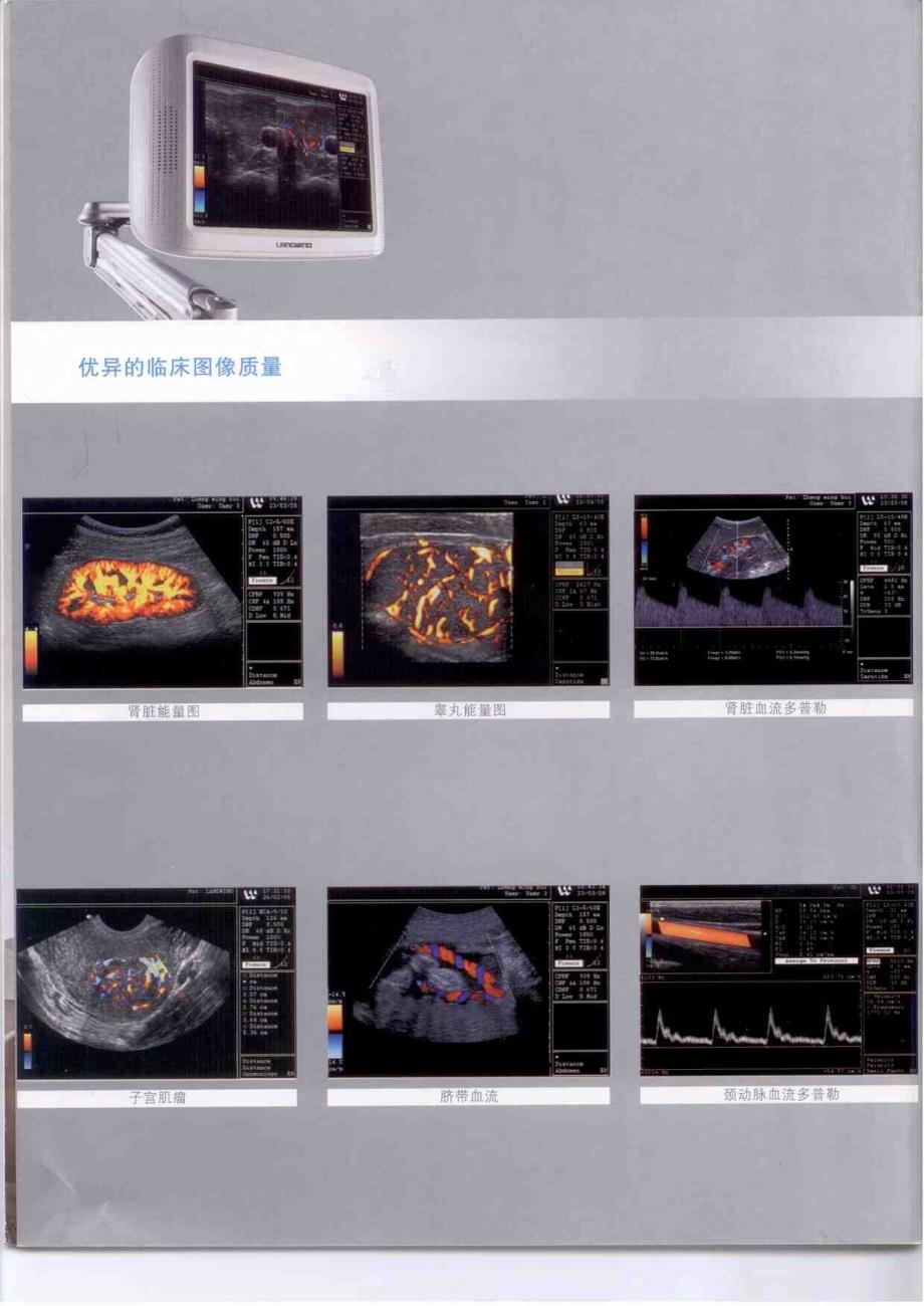 国产彩超mirror2_第4页