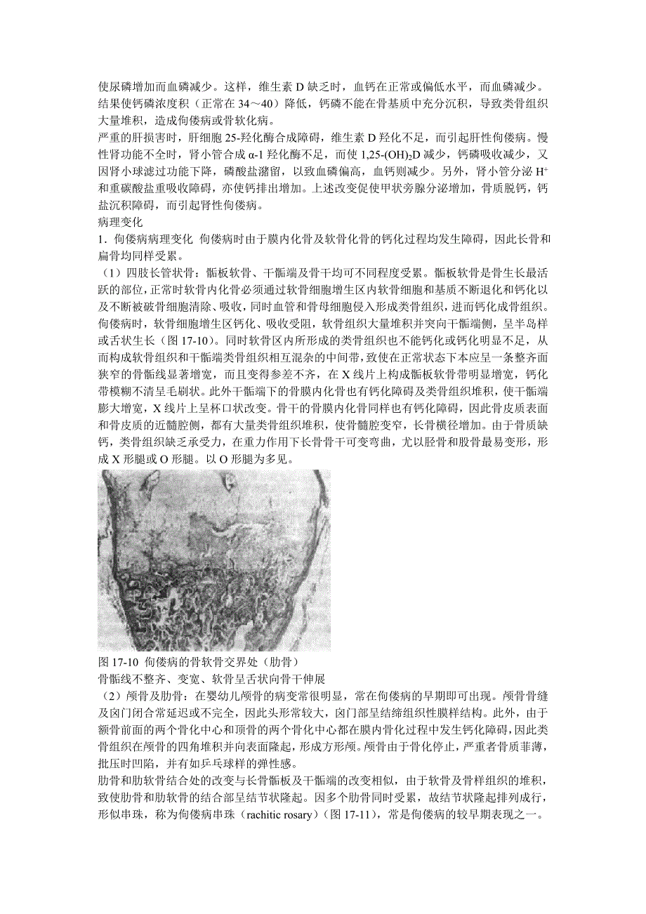 维生素d缺乏性佝偻病课件详细要点_第3页