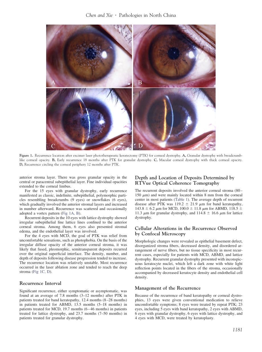 中国北方前角膜病患者经准分子激光角膜切削术治疗后的复发特点_第3页