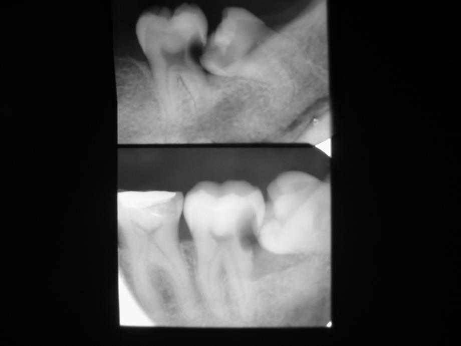 牙与牙周疾病_第4页