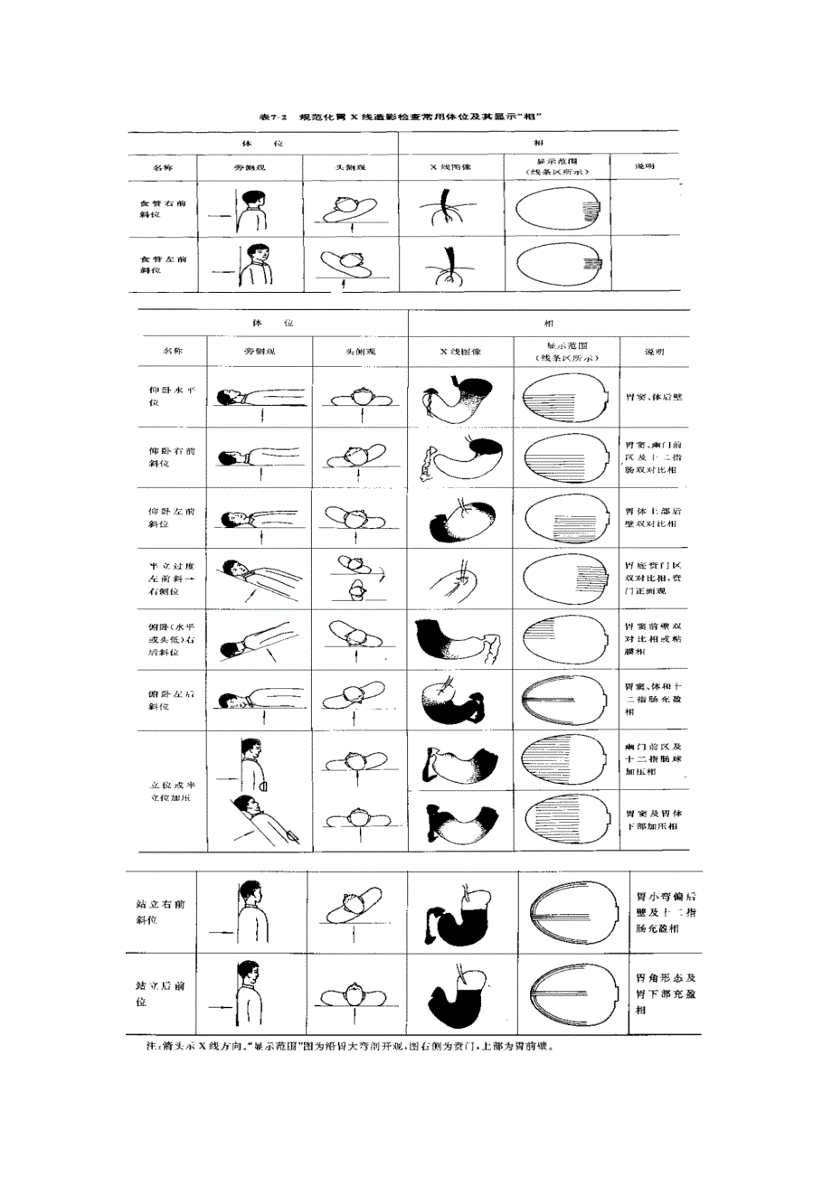 胃肠造影体位图示_第1页