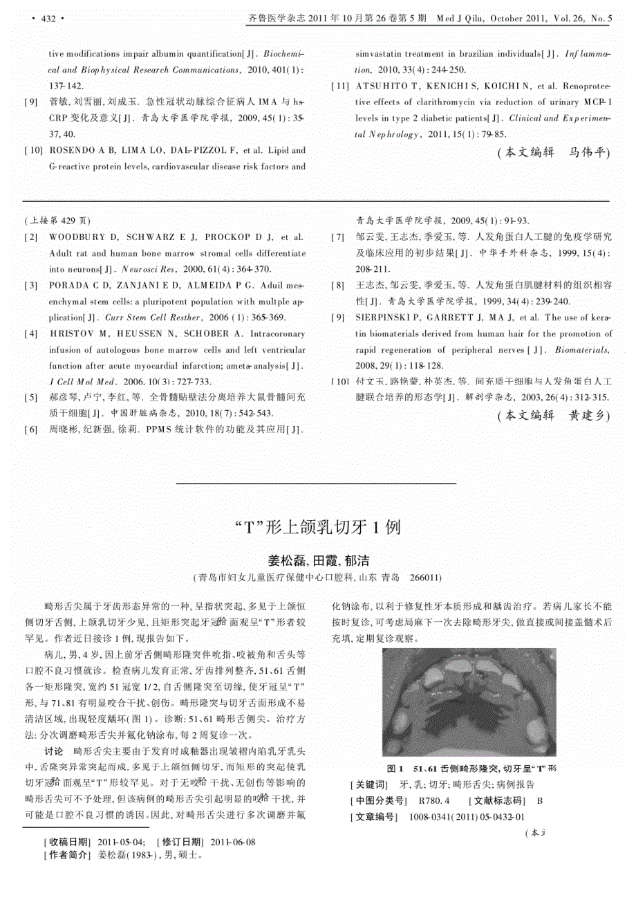 T形上颌乳切牙1例_第1页