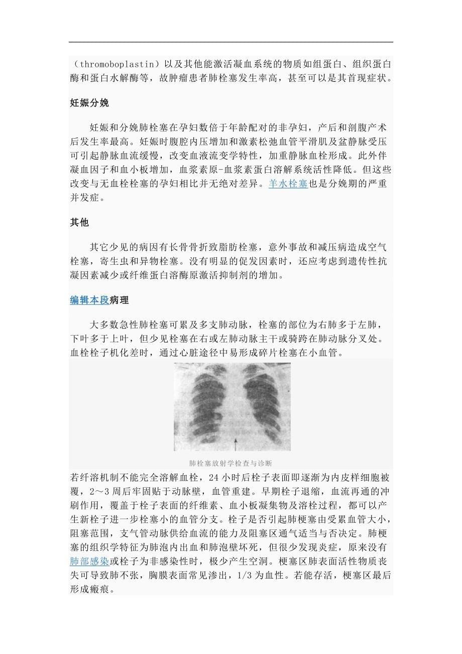肺栓塞的临床诊断与治疗_第5页