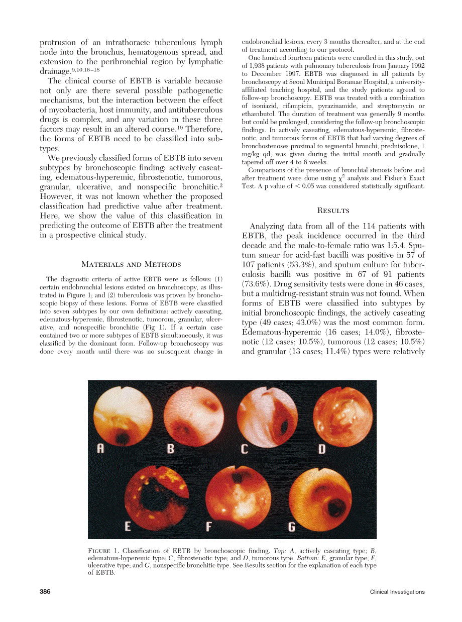 支气管结核经典分类_第2页