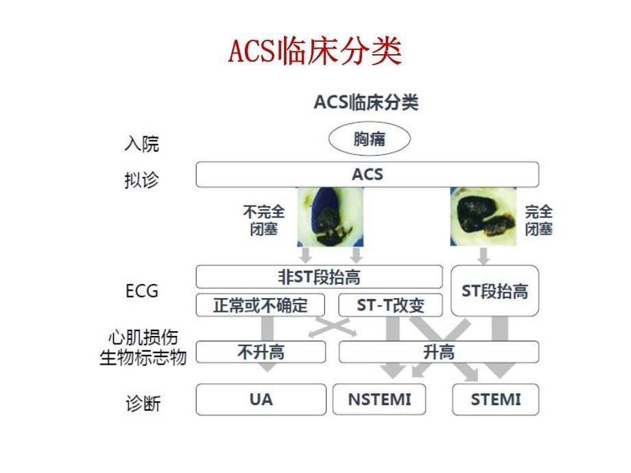 生物学标志物在ACS诊断和危险分层中应用进展(2016杭州)_第5页