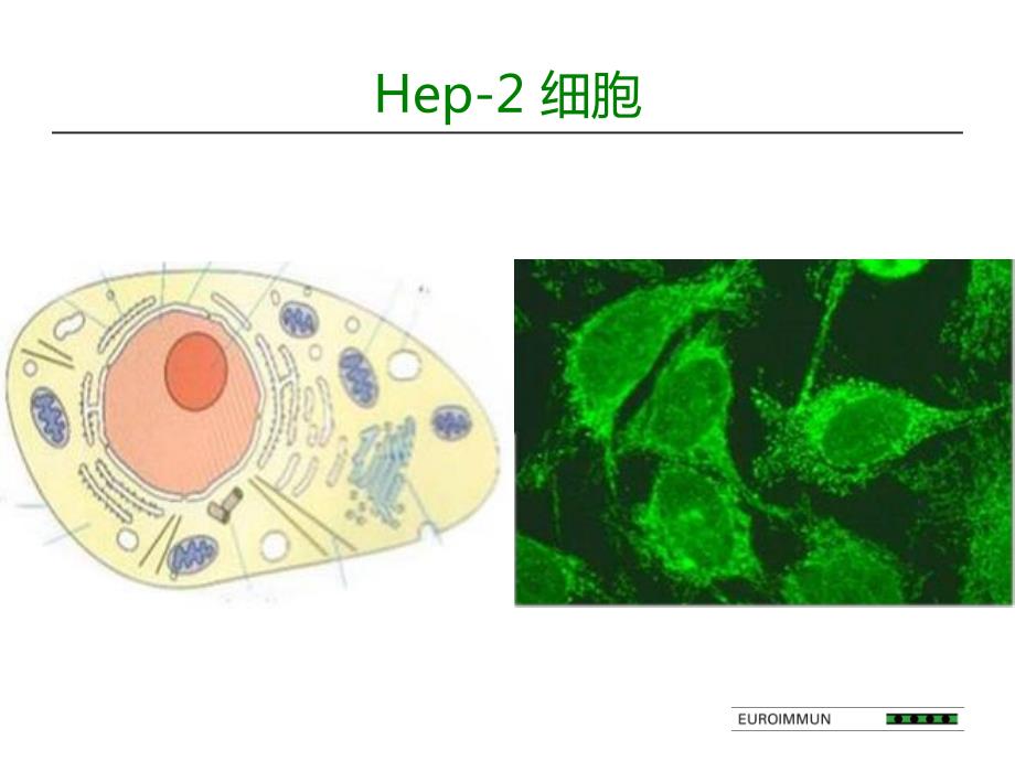 自身抗体荧光片模板片阅读_第4页