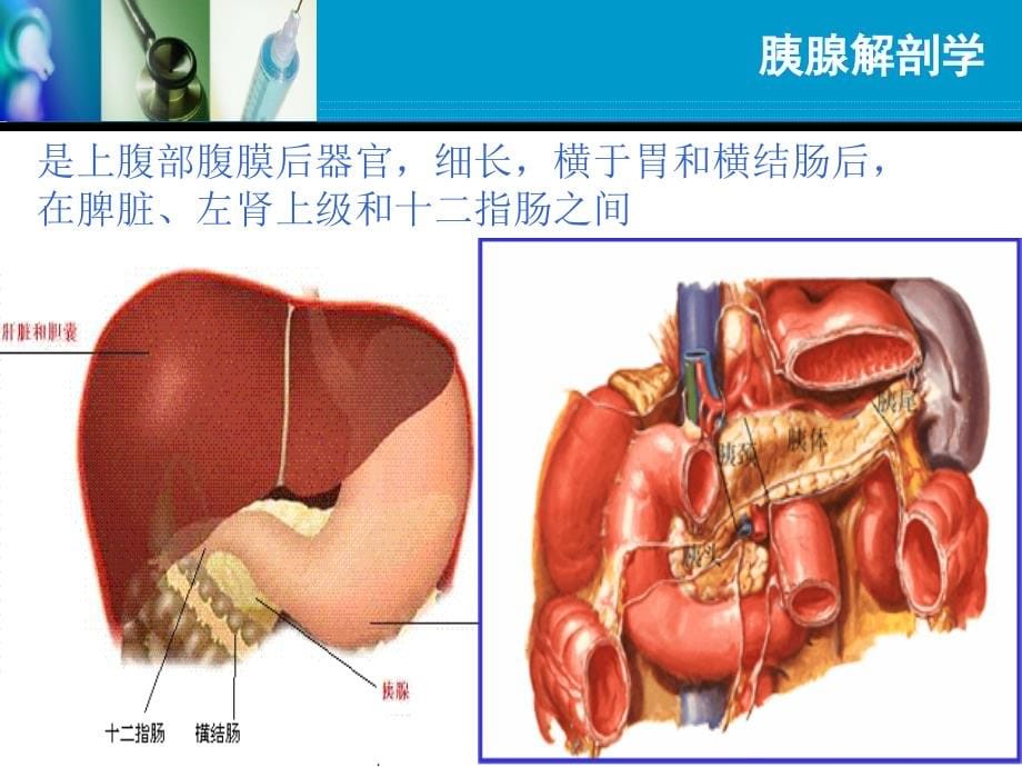 急性胰腺炎教学查房_第5页