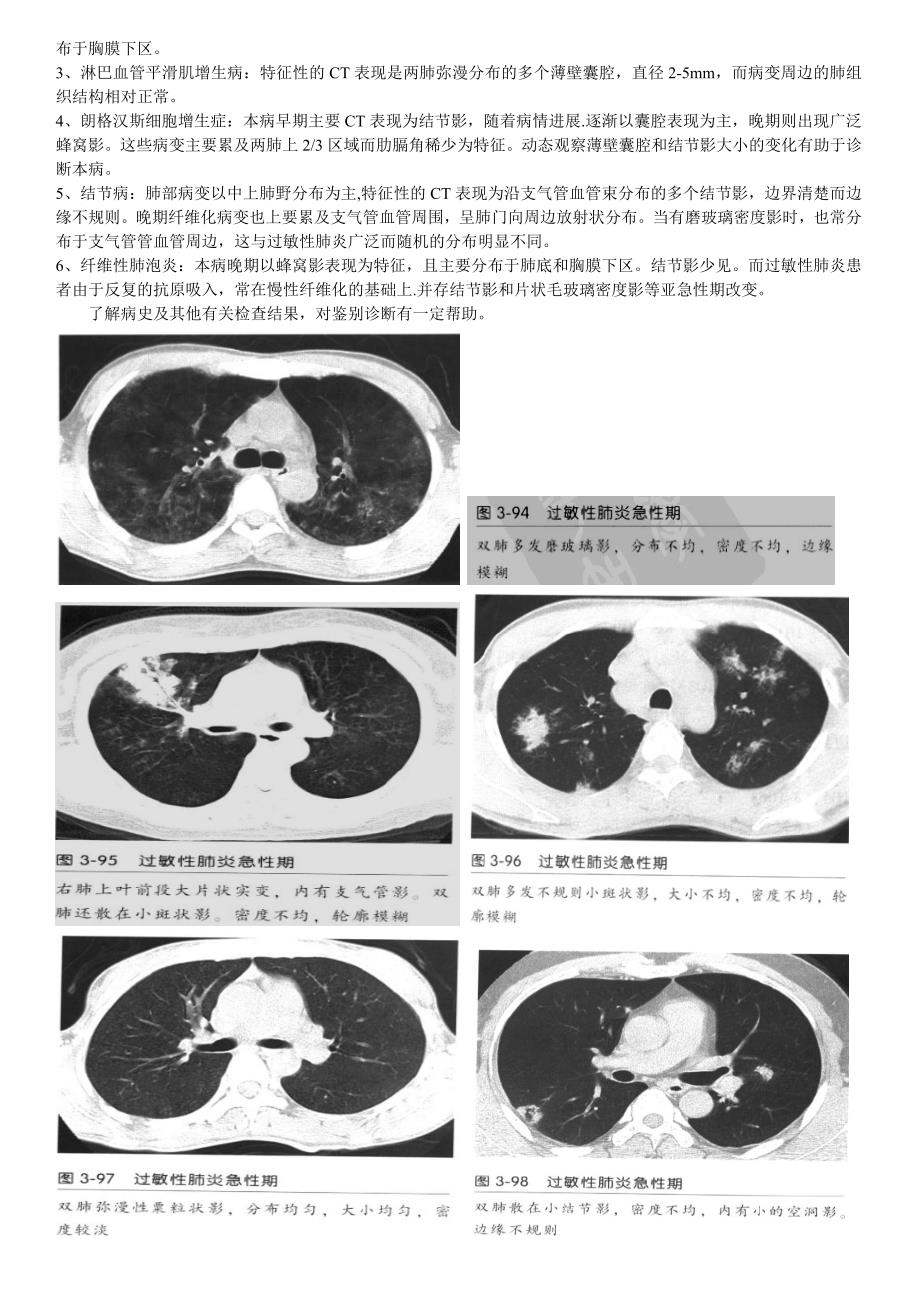 过敏性肺炎ct征象_第2页