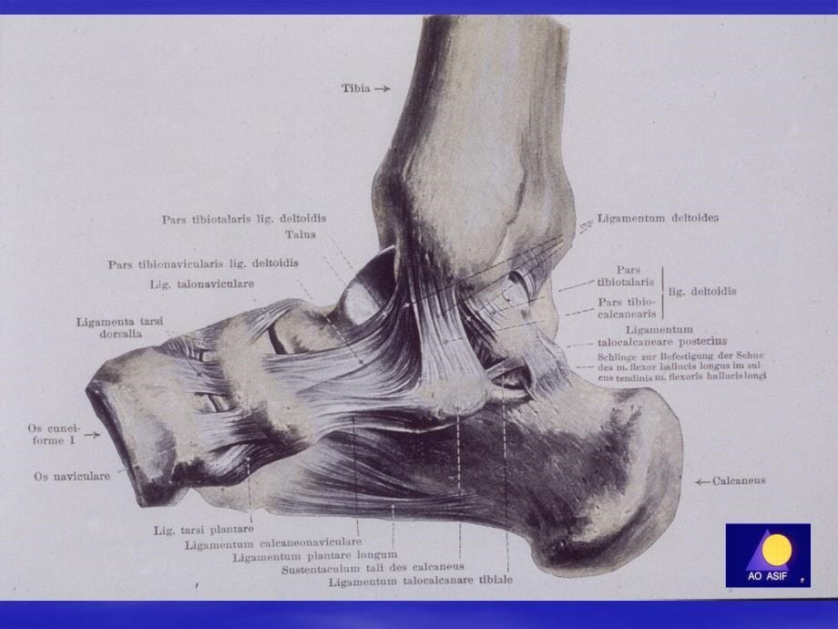 ankle fracture(踝关节骨折)_第5页