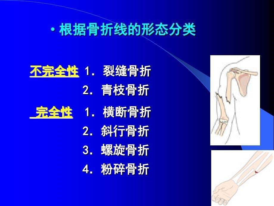 骨折病人的护理_第5页