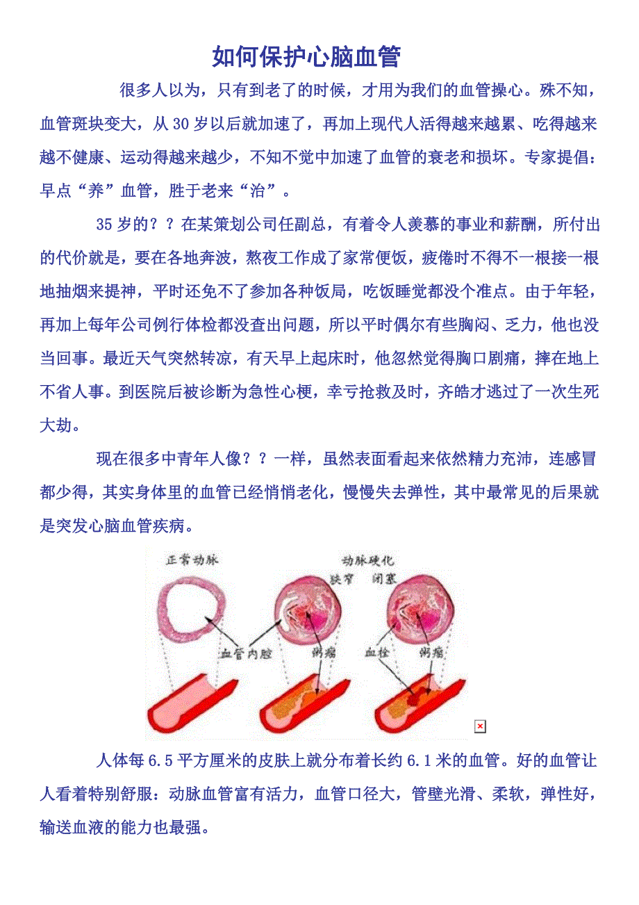 如何保养心脑血管_第1页