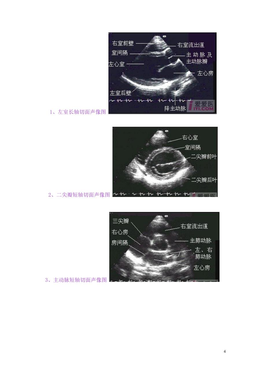 心脏(正常解剖模式图及超声声像图)_第4页