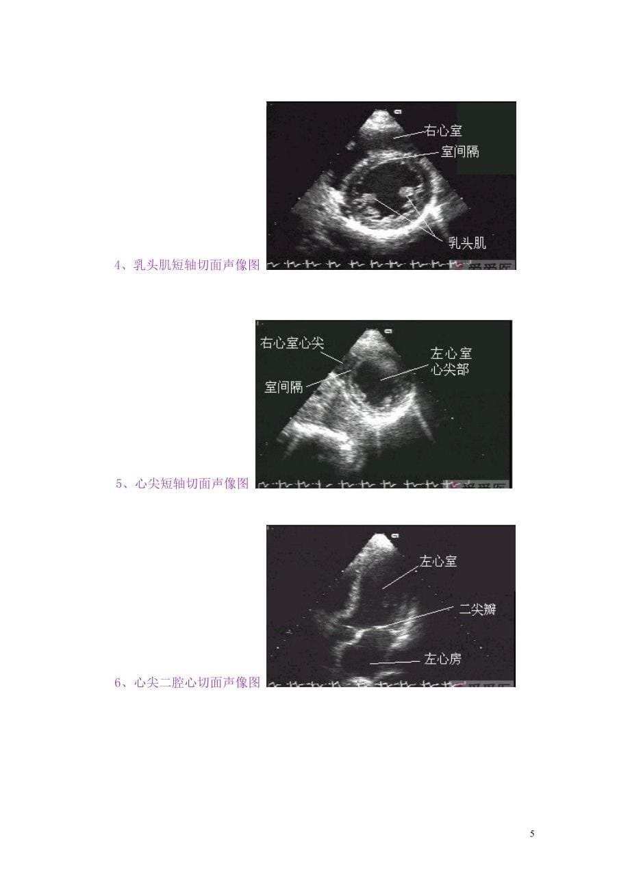 心脏(正常解剖模式图及超声声像图)_第5页